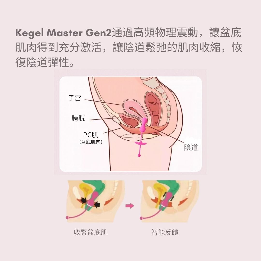 Kegel Master Gen2智能收陰球